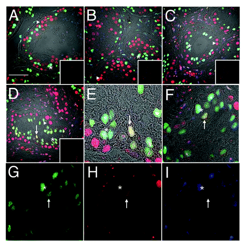 Figure 2. Downregulation of androgen receptor immunoreactivity in PCNA-positive Sertoli cells. Confocal immunofluorescence of human testis sections from normal (A) or gonadotropin-suppressed men (B, 2 wk; C–I, 12 wk). Sections were probed for GATA-4 [green, Sertoli cells within the seminiferous epithelium, asterisks), androgen receptor (blue, Sertoli (asterisks), Leydig and peritubular cells], and PCNA (red, labeling predominantly germ cells, triangles). Colocalization of GATA-4 and PCNA in Sertoli cells indicated by yellow (arrows). G–I are individual channels of the merged image in F, highlighting a GATA4 and PCNA-positive, AR-negative Sertoli cell (arrow) and a GATA4 and AR-positive, PCNA-negative Sertoli cell (asterisk). Inserts are controls where primary antibody was substituted for non-specific antibody of the same isotype. (Bar = 50 µm).