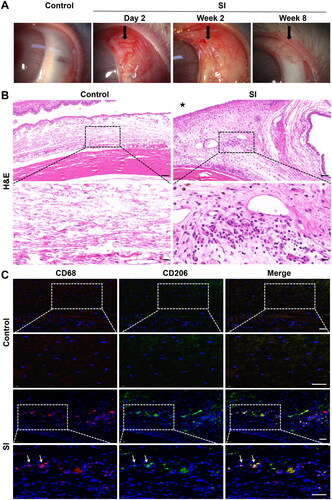 Figure 1. Histopathological evaluation in the early recovery phase following SI. Eyes with SI surgery were enucleated 2 weeks after surgery (SI group), and eyes without any treatment served as controls (n = 3 per group). (A) Macroscopic appearance of rabbit eyes with SI showed conjunctival hyperaemia and chemosis in the early postoperative phase and thickening and fibrotic tissue in the surgical area in the late phase. Original magnification: 10×. (B) Representative micrographs of tissue sections from the controls and SI group. Black asterisk marked the position of the silicone implant. H&E staining revealed significant inflammatory cell infiltration in the surgical area. Scale bar: 100 μm (20 μm within the enlarged box). (C) Immunofluorescent double staining of macrophages with anti-CD68 (red) and anti-CD206 (green) antibodies. There were more CD68+/CD206+ macrophages (white arrows) in surgical areas in SI group than in the controls. Scale bars: 50 μm.