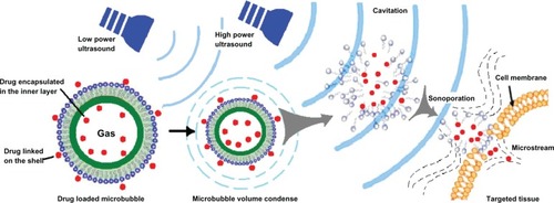 Figure 2 Illustration of the wide potential of drug-loaded microbubbles.