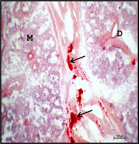 Figure 18. Photomicrograph of mandibular salivary gland of 40.5 cm CVRL (165th day) buffalo foetus showing lipid droplets (arrows) in the interlobular septa. (M-mucous cell; D-duct). Oil-red-o method ×100.