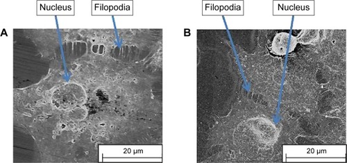 Figure 2 Scanning electron microscope images of bioimprints of Ishikawa endometrial cancer cells.Notes: (A) A negative polystyrene imprint and (B) a positive polystyrene imprint. The images illustrate the retained fidelity of the fine features of cells during fabrication of the imprints.