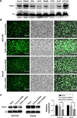 Figure 2 Infection of CRC cells by CDKL1-shRNA lentivirus.