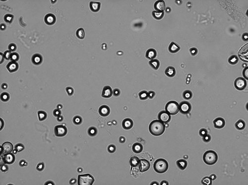 Plate 1 Typical native starch granule observed before heat treatment.