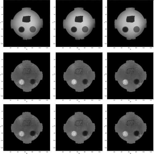 Figure 18. Results of phantom experiment. Images in the top row are the MR magnitude images in three different slices. The middle row shows the reconstructed conductivity images without considering the influence of Jz component. The bottom row shows the reconstructed conductivity images using the two-step algorithm considering the influence of Jz component.