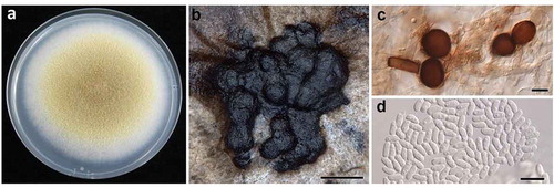 Fig. 3. (Colour online) Didymella americana. a, gross colony morphology of 7-day-old culture on potato dextrose agar. b, pycnidia (scale bar = 100 µm). c, chlamydospores (scale bar = 10 µm); and d, conidia (scale bar = 10 µm).