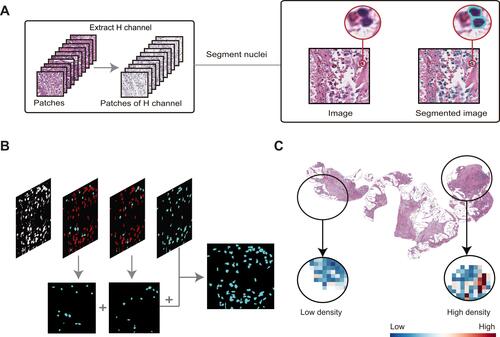 Figure 2 Nuclei segmentation and heat map. (A) Process and result of nuclei segmentation. (B) A rough expression of the nuclei segmentation method based on preservation and subdivision. (C) Heat map showed the density calculation results of each patch.