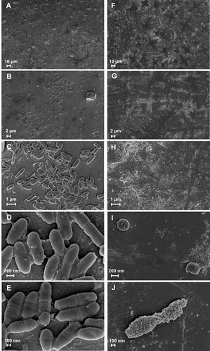 Figure 10 SEM image of the retrieved abutments after microbiological studies showing significantly more bacterial biofilm attached on the control implants (A–E) than those modified with ZnO+0.1%Ag NPs (F–J).