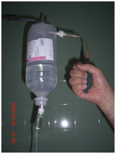 Figure 3 Hand pumping to increase pressure.