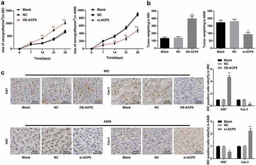 Figure 6. ACP5 knockdown inhibits LC tumor growth in vivo. a. The curve of xenograft tumor volume in mice with overexpressed ACP5 or inhibited ACP5; b. Relative xenograft tumor weight in mice with overexpressed ACP5 or inhibited ACP5; c. Representative images and statistical chart of positive rate of Ki67 and PARP in mice with overexpressed ACP5 or inhibited ACP5 determined by immunohistochemistry. * p < 0.05, ** p < 0.01, compared with the NC group. LC, lung cancer; ACP5, tartrate-resistant acid phosphatase 5; NC, negative control