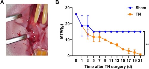 Figure 1. Impaired MWT in TN rat. (A) Representative images of the CCI-ION procedure in rat. (B) The nociception of rats was evaluated by MWT test on the time-point of 0, 1, 3, 5, 7, 9, 11, 13, 15, 17, 19, 21 d after CCI-ION surgery. ** p < 0.01.