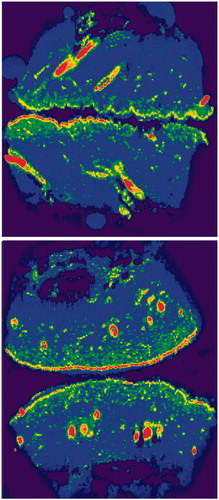 Figure 4. LA-ICP-MS bioimaging of endogenous sulfur (34S) in MAZ-DD (above) and non-laser exposed (below) porcine skin, normalized against 13C. Notable 34S detection is seen corresponding to hair shafts, the outermost stratum corneum and to a lesser extent, the underlying epidermal layers.