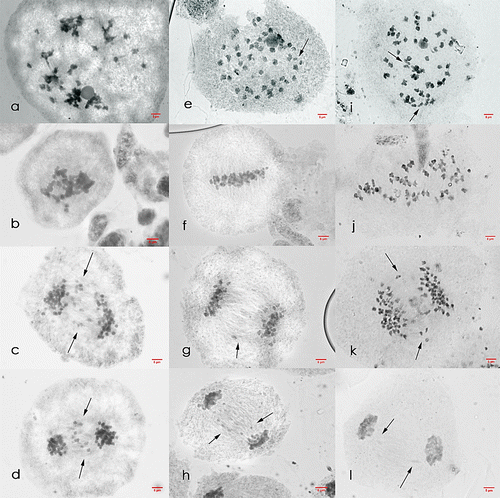 Figure 3. Meiosis I cells of Saccharum officinarum L. (OIO, 1000×). (a–d) var. VMC 74-292: (a) chromosome stickiness at diakinesis; (b) multipolar metaphase I plate; (c) anaphase I with laggards; (d) telophase I with laggards. (e–h) var. CP 72-1312: (e) diakinesis with 47II + 2I; (f) metaphase I; (g) anaphase I with laggards; (h) telophase I with laggards. (i–l) var. PSR 97-45: (i) diakinesis with 41II + 4I; (j) non-congression at metaphase I; (k) anaphase I with laggards; (l) telophase I with laggards.