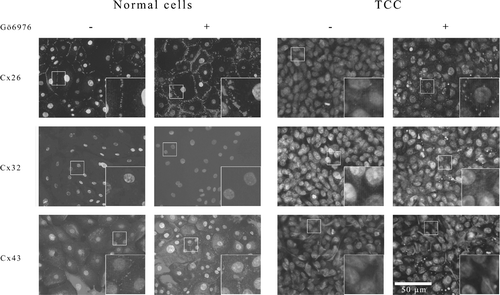 Figure 4 Indirect immunofluorescence labeling using monoclonal antibodies against connexins 26, 32, and 43. Panels in the left demonstrate expression of different connexins in normal urothelial cells culture before (−) and after (+) Gö6976 tretament. Panels in the right demonstrate the expression of different connexins in TCC cell culture without (−) and with (+) Gö6976 treatment. Nuclei have been stained with hoechst (blue) and connexin immunosignal is in red. All images are presented with the same magnification. Small boxes within panels show a demonstrative area of each picture in higher magnification. Scale bar 50 μm.