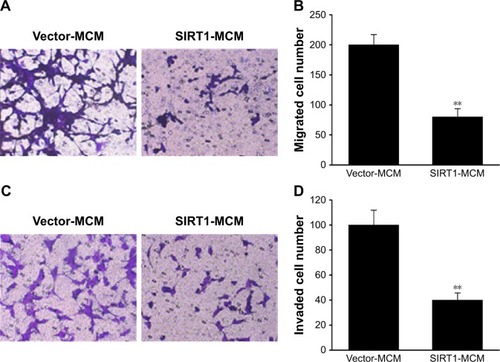 Figure 4 SIRT1 inhibited migration as well as invasion of HCC cells.Notes: HepG2 cells received a supplement of conditioned medium from macrophages (MCM), which were transfected with SIRT1 or vector. (A) Images of HepG2 cells with migration ability on the bottom surface of transwell membranes. (B) Number of HepG2 cells with migration ability in five random fields under a microscope from various groups. (C) Images revealing HepG2 cells with invasion ability on the bottom surface of transwell membranes. (D) HepG2 cells with invasion ability in five random fields under a microscope from various groups. Results are displayed as mean ± SEM. **P<0.01 vs vector-MCM group.Abbreviations: HCC, hepatocellular carcinoma; MCM, macrophage-conditioned medium; SEM, standard error of mean.