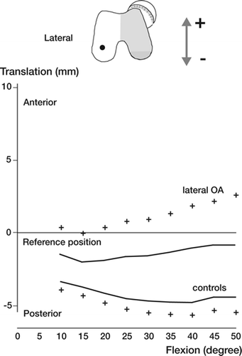 Figure 16. Anteroposterior translations of the lateral flexion facet center are illustrated. These motions were small without any substantial difference between the two groups. Numbers of observations are according to Figure 13. Mean and standard error of the mean (SE) are shown.