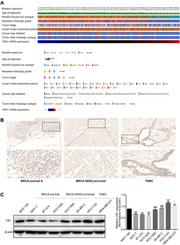 Figure 3 The correlation between YBX1 expression and clinicopathological parameters in BRCA.