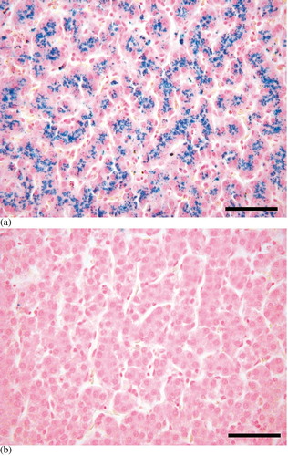 Fig. 1 Liver iron distribution. Hepatocytes containing high amounts of iron (blue) in the mynah (1a). No iron is stained in the chicken (1b). Perl's iron stain. Bar=50 μm.