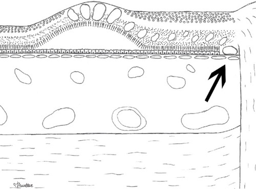 Figure 4 Artist rendition of the macula.