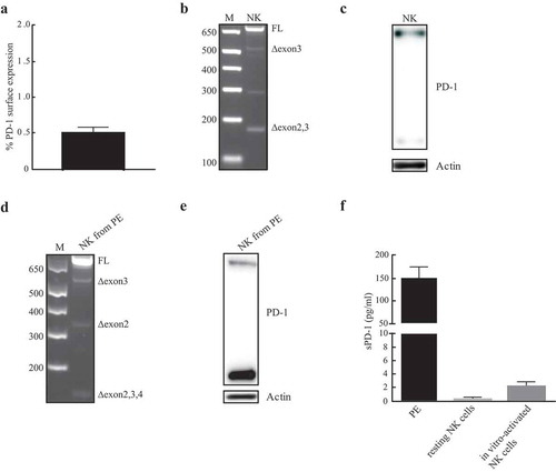 Figure 2. Detection of PD-1 mRNA isoforms and protein in IL-2 activated NK cells and in NK cells isolated from malignant PE. (a) Percentages of PD-1 surface expression in in vitro-activated NK cells isolated from HDs. (b) Analysis of PD-1 mRNA isoforms on NK cells. One representative HD, out of three analyzed, has been reported. (c) Total protein extracts isolated from in vitro-activated NK cells were analyzed for PD-1 expression. (d) Analysis of PD-1 splicing variants in NK from PE. (e) PD-1 protein profile of PE infiltrating NK cells. (f) sPD-1 has been studied in PE or supernatants (SN) of both resting and IL-2-activated NK cells isolated from HDs. Data for PE and HDs are relative to four and three different samples, respectively. sPD-1 concentration (pg/ml) has been calculated by use of a four-point-fit calibration curve of the standard dilutions.