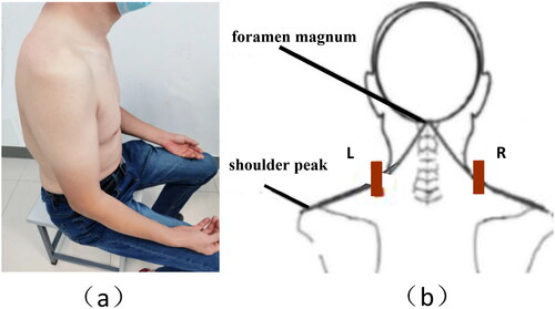 Figure 2. (a) The participants were seated, fully exposed to the shoulder and neck, with their forearms relaxed and palms facing upward on the same thigh. (b) The midpoints of the line between foramen magnum and left or right acromion were selected as the image Collection points of trapezius muscle on both sides.