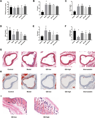 Figure 1 Effect of Qianshan Huoxue Gao (QS) on atherosclerosis (AS) model rats. (A) Rate of body weight gain. (B) Total cholesterol (TC). (C) Low-density lipoprotein cholesterol (LDL-C). (D) High-density lipoproteins cholesterol (HDL-C). (E) Triglycerides (TG). (F) Adiponectin (ADPN). (G) Hematoxylin and eosin (HE) staining of aortic vessels in different groups. (H) Oil red O staining of aortic vessels in different groups. (I) HE staining of the skin in the QS groups. #P<0.05 compared with the control group; *P<0.05 compared with the model group.