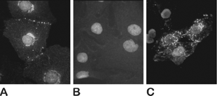 Figure 8 Immunofluorescence microscopy of cardiac myofibroblasts showing LI-induced changes in Cx43 localization/distribution. Control myofibroblasts (A, B) and myofibroblasts subjected to LI (C). Negative control were performed by omitting the primary antibodies and subsequent labeling with Alexa Fluor 488 secondary antibodies (B). Nuclei were stained with DAPI. (See Color Plate I at the end of this issue).