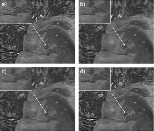 Figure 1. (a) A video snapshot of the actual scene (original image) of the phantom experiment, and (b) the corresponding LR images obtained by down-sampling. (c) For comparison, the LR image in (b) was re-sampled using cubic interpolation. (d) The resulting image after application of the described POCS super resolution algorithm; the insert demonstrates the high-resolution details recovered by the proposed algorithm.