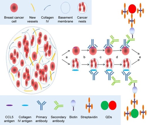 Figure 1 CCL5 and collagen IV testing.Notes: CCL5 expressed in the cytoplasm of cancer cell and collagen IV expressed in the BM were imaged and detected simultaneously and quantitatively by QD-based system. a, heating, dewaxing, hydration; b, antigen retrieval, blocking, adding the first antibody; c, rinsing, blocking, adding the second antibody; d, rinsing, blocking, adding QDs-SA; e, rinsing, sealing, observation.Abbreviations: BM, basement membrane; CCL5, chemokine (C–C motif) ligand 5; QD, quantum dot.