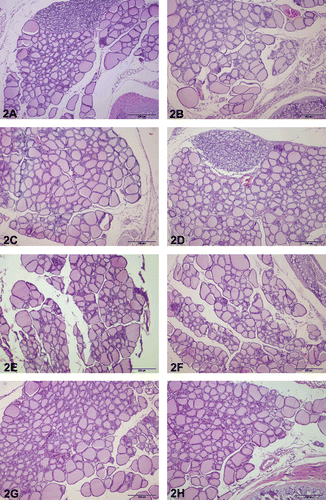Figure 2.  Thyroid histology of control and F. sellowiana extracts treated rats. The glands showed no microscopic abnormalities. Normal thyroid architectures are seen as small follicles at the central portion of gland and large follicles at the periphery of the gland in all groups. Representative figures were stained with H&E. The original magnification was 100x, and the scale bars represent 200 µm. (A) Control group (any application). (B) Carboxymethyl cellulose group (0.5% sodium carboxymethyl cellulose). (C) Methanol extract group. (D) Hexane extract group. (E) Chloroform extract. (F) Ethyl acetate extract. (G) n-Butanol extract. (H) Aqueous extract.