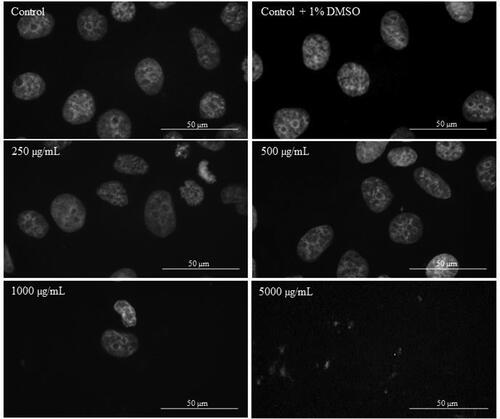 Figure 7. DAPI staining of MCF-7 cells treated with different concentrations of Butterbur extract 72 h. Bar is 50 µm.