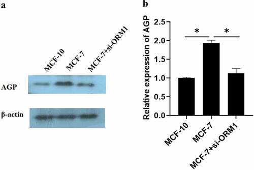Figure 5. Expression of AGP in MCF-10, MCF-7, and MCF-7+ si-ORM1 cells determined using Western blot analysis. (a-b). AGP protein expression in MCF-7 breast cancer cells and cells transfected with si-ORMI were evaluated by Western blotting analysis (*P < 0.05). The experiments were conducted in triplicate.