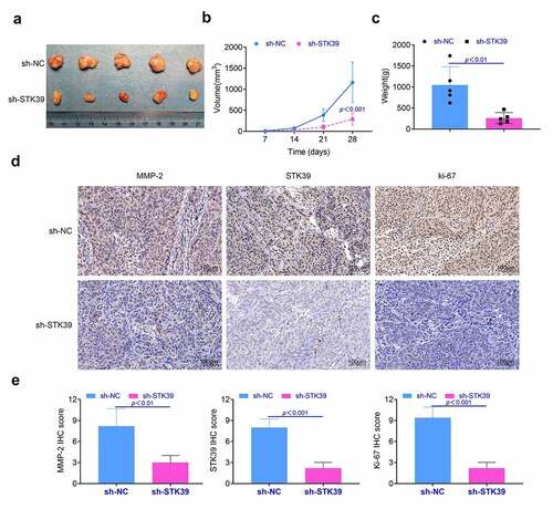 Figure 5. Knockdown of STK39 suppressed the proliferation of HCC cells in vivo. (a) The proliferation of HCC cells in vivo was detected with the animal assays. (b, c) Volume and weight of tumor tissues were measured after the sacrifice of these mice. (d) The expression of Ki-67, MMP-2 and STK39 in tumor tissues was determined with the immunohistochemistry, the IHC scores were calculated. Five mice per group. Each experiment repeated for three times. **p < 0.01 vs. sh-NC