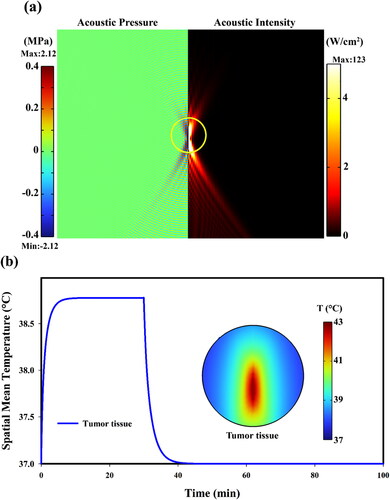 Figure 6. (a) the spatial distribution of acoustic intensity and pressure in the computational domain. It should be mentioned that since acoustic field is solved in a frequency domain, so the acoustic pressure and intensity profiles are not changing over time; (b) Spatiotemporal temperature distribution in tumor tissue (maximum value: 43 °C) considering temperature controller 15 min after appling FUS.