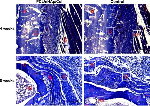Figure 7 Masson’s stain of interface between autologous tendon and host bone 4 or 8 weeks after ACL surgery in a rabbit model.Notes: (A and C) PCL/nHAp/Col-wrapped tendon group; (B and D) PCL-wrapped autologous tendon group as a control (×40 magnification). The formation and infiltration of the collagen fibers and bone formation at the interface of the graft and the host bone was observed 8 weeks after surgery (arrows). Scale bars =200 µm.Abbreviations: ACL, anterior cruciate ligament; Col, collagen; HB, host bone; G, autologous tendon graft; nHAp, nanohydroxyapatite; PCL, polycaprolactone.