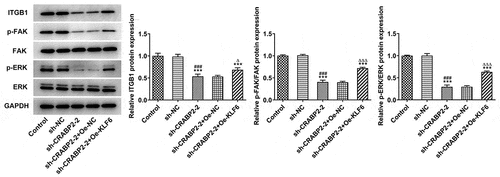 Figure 7. CRABP2 knockdown suppresses the integrin-β1/FAK/ERK pathway. The expression of ITGB1, p-FAK/FAK and p-ERK/ERK in WERI-RB1 cells was detected by Western blot. ***P < 0.001 vs. control group. ###P < 0.001 vs. sh-NC group. ∆P < 0.05 and ∆∆∆P < 0.001 vs. sh-CRABP2-2+ Oe-NC group.