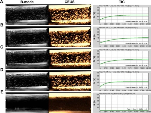 Figure 6 In vitro B-mode, CEUS images and TIC of (A) DNCs, (B) VNCs, (C) PNCs, (D) NNCs, and (E) pure degassed deionized water under the same concentration (0.5 mg/mL).Notes: DNCs, dual-targeted gold nanoshelled poly(lactic-co-glycolic acid) nanocapsules carrying anti-vascular endothelial growth factor receptor type 2 antibody and anti-p53 antibody; NNCs, non-targeted gold nanoshelled poly(lactic-co-glycolic acid) nanocapsules; PNCs, single-targeted gold nanoshelled poly(lactic-co-glycolic acid) nanocapsules carrying anti-p53 antibody; TIC, time-intensity curves; VNCs, single-targeted gold nanoshelled poly(lactic-co-glycolic acid) nanocapsules carrying anti-vascular endothelial growth factor receptor type 2 antibody.Abbreviations: B-mode, brightness mode; CEUS, contrast-enhanced ultrasound.