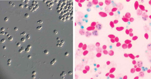 Figure 1. Vegetative cells (grown in liquid wart, 400× magnification by optical microscopy, left) and ascospores (stained green, blue, or colourless, right) of Pichia manshurica isolated from Daqu used for Shanxi Aged Vinegar brewing.
