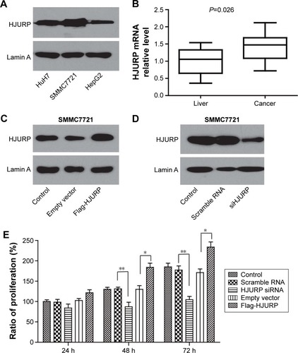 Figure 3 HJURP promotes HCC cell line proliferation. (A) HJURP expression in HCC cell line HuH7, SMMC7721, and HepG2 was detected by Western blotting. (B) HJURP mRNA level in HCC tissues was significantly higher than that of the corresponding normal liver tissues (P=0.026). (C) Successful HJURP overexpression in SMMC7721 was verified by Western blotting. HJURP was cloned into pFLAG-CMV2 by double digestion with restriction enzymes and transfected into SMMC7721. HJURP expression 48 h after transfection was detected by Western blotting. (D) Successful HJURP knockdown in SMMC7721 was verified by Western blotting. HJURP knockdown was performed by siRNA. HJURP expression 48 h after siRNA transfection was detected by Western blotting. (E) Cell proliferation was detected by MTT assay in SMMC7721 cell line after regulating HJURP expression. After 24 h of transfection with scrambled RNA, siRNA, control vector, or Flag-HJURP vector, cells were passaged into 96-well plates and starved for 6 h. Then medium containing 10% FBS was added, which was set as time 0. Cell proliferation at time point 24, 48, or 72 h after time 0 was detected. The proliferation ratio of group without any treatment (control group) at 24 h was set as 100% and other groups were standardized with this baseline. Column graph was displayed with ± SEM. *P<0.05 and **P<0.01.