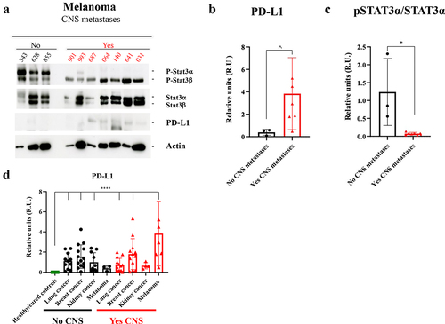 Figure 5. Study of pSTAT3/STAT3 and PD-L1 expression by Western blot in plasma-circulating sEVs from patients with melanoma. a. Western blot image of the expression of different proteins (indicated on the right) in sEVs from melanoma patients according to the absence (No) or presence (Yes) of central nervous system (CNS) metastases. Ponceau staining was used as loading control (see Supplementary Figure 4 F). b. Quantification of PD-L1 expression levels and statistical analysis of samples considered in A. The data obtained for PD-L1 in densitometry were normalized to Ponceau values (see Supplementary Figure 4). c. Quantification of pSTAT3α/STAT3α band expression levels and statistical analysis of samples considered in A. d. Quantification of PD-L1 expression levels and statistical analysis of the whole population of this study, including the healthy/cured controls group. The data obtained for PD-L1 in densitometry were normalized to Ponceau values (see Supplementary Figure 4). No CNS: Absence of CNS metastases. Yes CNS: Presence of CNS metastases. ^ p value 0.03. * p value 0.02. **** p value < .0001.