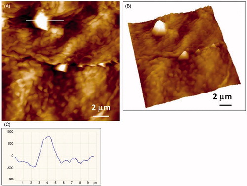 Figure 7. AFM imaging of the 12th SC tape of of an AD patient revealing particles of micrometric dimensions: (A) height image of the crystallites (vertical scale 1.2 mm); (B) 3D view; (C) height profile of the large crystallite along indicated line in A.
