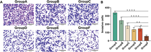 Figure 7 Combination therapy reduced the invasion ability of HepG2 cells. (A) Transwell assay was performed in HepG2 cells to investigate the inhibitory effect of combination treatment on HCC metastatic processes. (B) Quantitation of migrated cell number of HepG2 cells. *p<0.05, **p<0.01, ****p<0.0001.