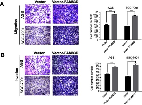 Figure 6 Overexpression of FAM83D facilitates migration and invasion in vitro. (A) The migration assay using AGS and SGC-7901 transfected with FAM83D or vector. (B) The invasion assay using AGS and SGC-7901 transfected with FAM83D or vector. Left panel: representative image; Right panel: quantification of the colony numbers. Statistical method: independent t-test. Significant difference: p<0.05. ***p<0.001.