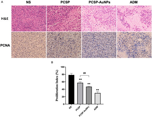 Figure 7. Pathological and histological observation of H22 tumors in mice. (A) H&E and PCNA staining of the tumors in different groups. (B) Proliferation index of different groups. *p < 0.05, **p < 0.01, compared to the control group; ##p < 0.01, compared to the PCSP group.