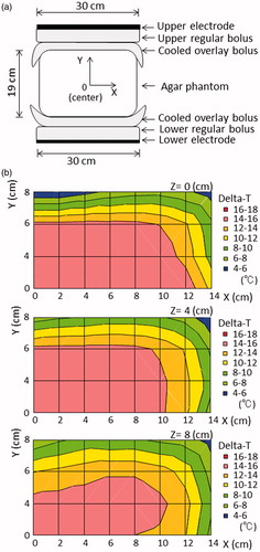 Figure 1. (a) Pattern diagrams of the conventional setting in the phantom study. (b) The distributions of the temperature increase in the phantom for the conventional setting. The superficial area was cooled by the overlay bolus, while the deep area was uniformly heated (with the exception of the external border).
