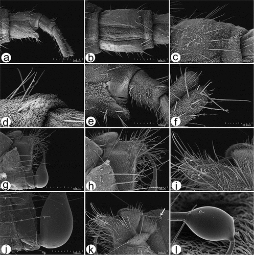 Figure 13. Scanning electron microscopy of Rhamphomyia aquila sp. nov. male and female genitalia. (a) Terminal female abdomen tergites; (b) in ventral view appear partially retracted into proximal segment; (c–e) seventh and eight segments of abdomen with longer chaetic sensilla dorsally; (f) thick, long chaetic sensilla of cerci; (g) smooth basal part of phallus; (h–i) long and rigid chaetic sensilla on genitalia; (j–l) phallus broad, covered by waxy secretions, and bulb-shaped apical portion (arrow).