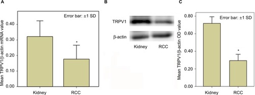 Figure 1 Different expression levels of TRPV1 in normal kidney vs RCC.Notes: (A) In quantitative RT-PCR, TRPV1 mRNA level was decreased 3.2-fold in the RCC vs kidney. (B) Western blot analysis reveals lower TRPV1 expression in RCC than in kidney samples. (C) Densitometric analysis of the TRPV1/β-actin protein bands in B. *A statistically significant difference of TRPV1 mRNA or protein levels in RCC vs normal peritumoral kidney tissues.Abbreviations: OD, optical density; RCC, renal cell carcinoma; RT-PCR, reverse transcription polymerase chain reaction; TRPV1, transient receptor potential vanilloid type-1.