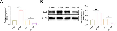 Figure 5. MTBP promoted the expression of ZEB2 in colon cancer cells. (A, B) The protein and mRNA levels of ZEB2 in MTBP overexpression or knockdown SW620 cells was determined with the western blotting. * p < 0.05, **p < 0.01.