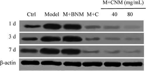 Figure 20. The expression of NF-κB protein in rats’ brain tissue in each group 1, 3, and 7 d after treatment.