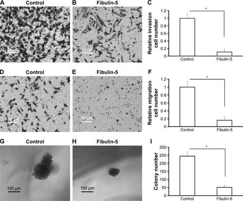 Figure 9 Fibulin-5 overexpression inhibits cell migration (A–C), cell invasion (D–F) and anchorage-independent growth (G–I) in glioma cells.