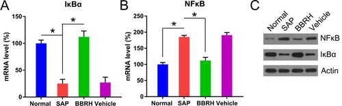 Figure 6. Transcription and translation of IκBα and NFκB p65 in pancreatic tissue. (A, B) Q-PCR is conducted to examine the expression of IκBα and NFκB p65 mRNA in pancreatic specimens after 12 h. GAPDH serves as an internal control. (C) WB is used to examine the protein concentration of IκBα and NFκB p65. Result is presented in the form of mean ± SD (n = 15 per group). Differences among various groups are assessed using ANOVA. *P < 0.05.